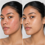 Mess-Free Clay Detox. Real Results.